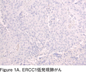 Figure 1A. ERCC1低発現肺がん