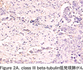 Figure 2A. class III beta-tubulin低発現肺がん
