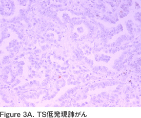 Figure 3A. TS低発現肺がん
