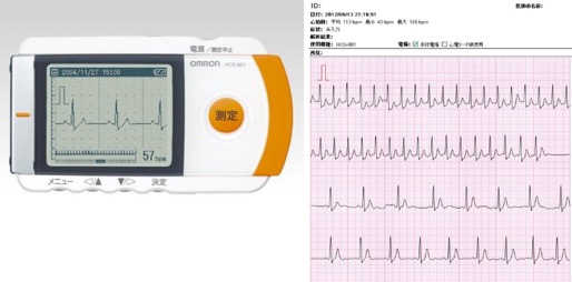 携帯心電計