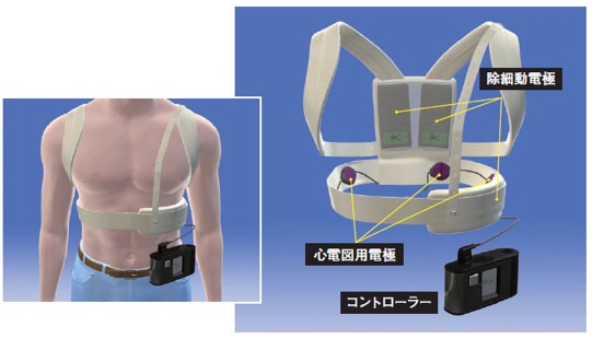 着脱型心臓除細動器（旭化成）
