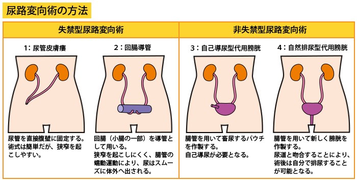 どのような症状がありますか?