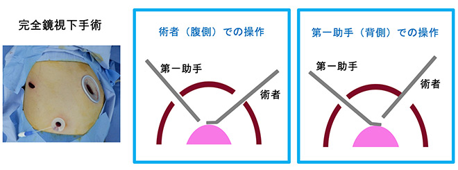 DualOperatorによる平行剥離