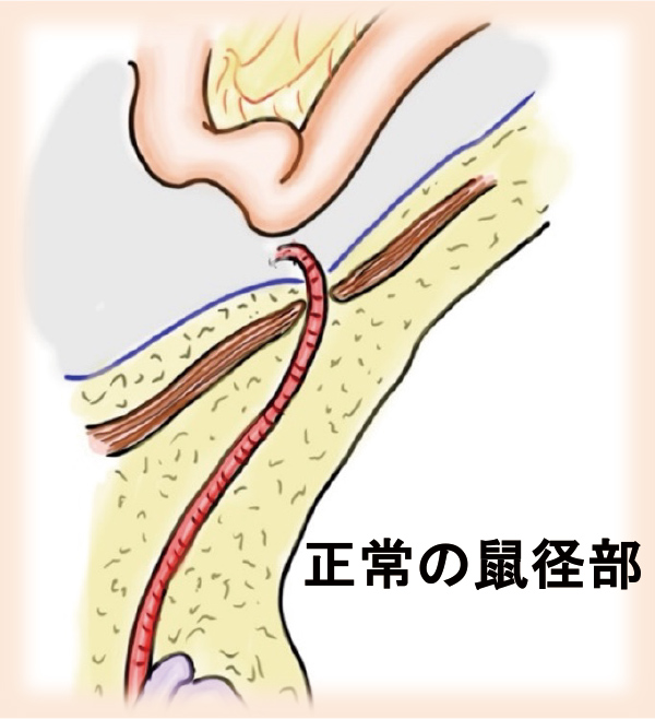 正常の鼠径部