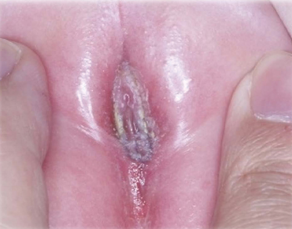 xxx