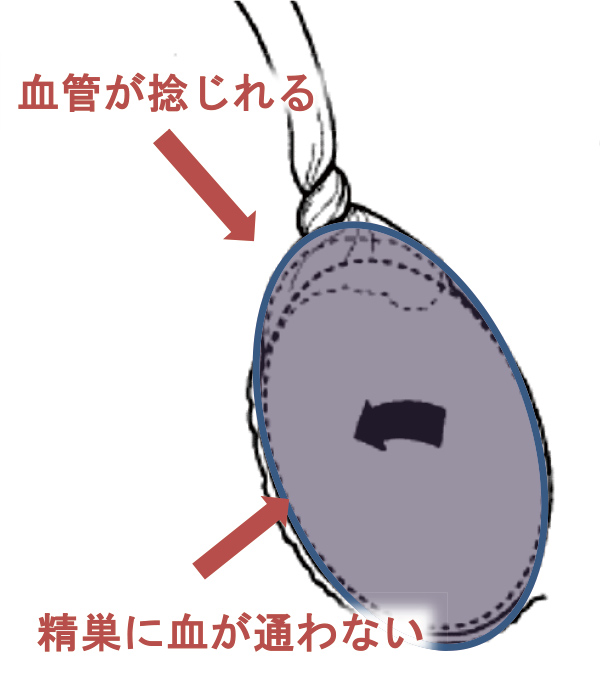 血管が捩れる 精巣に血が通わない