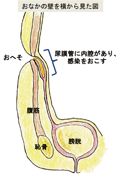 shonigeka_disease_urachal-remnant_01.jpg" alt="お腹の壁を横から見た図