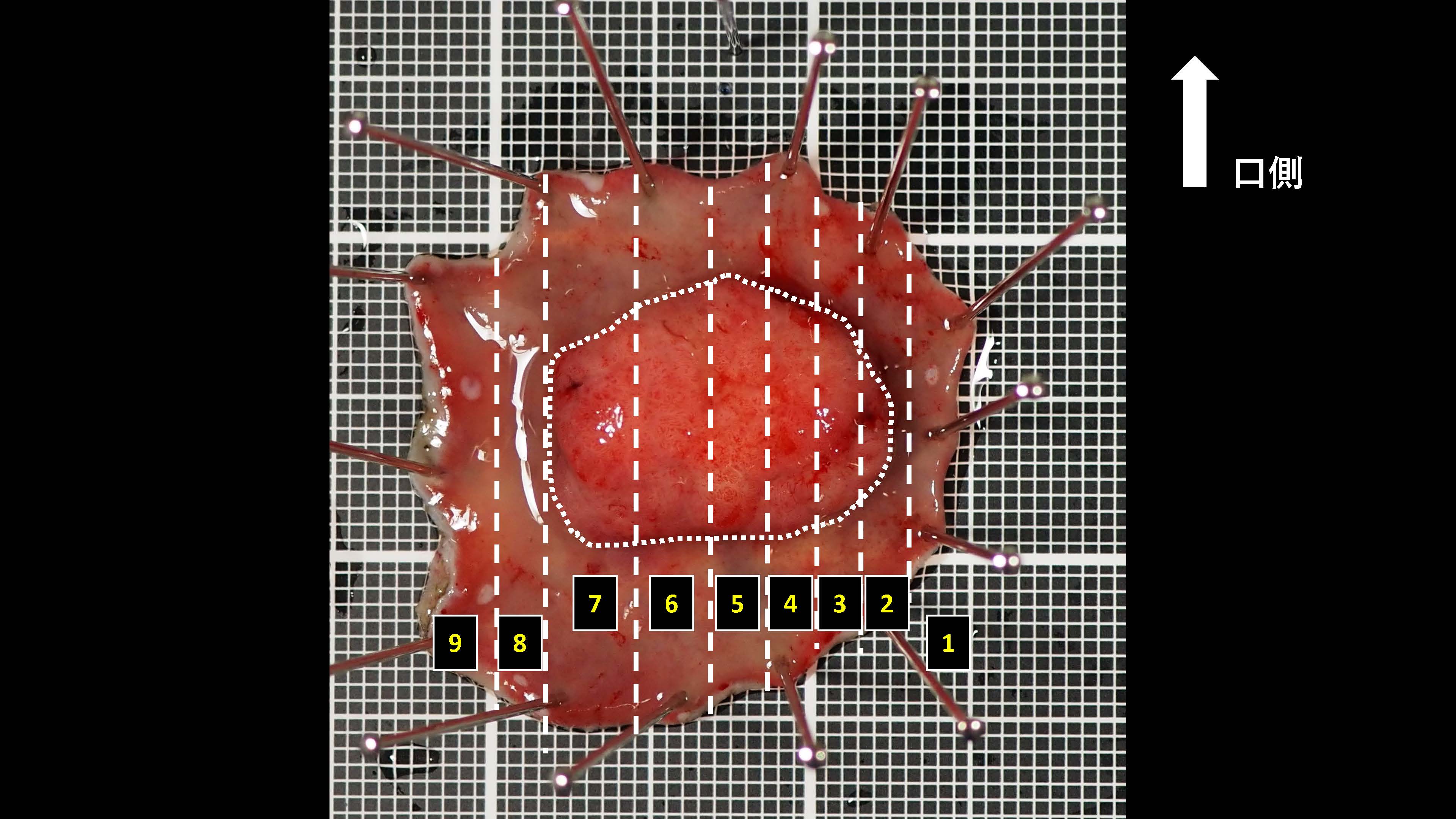 大腸024