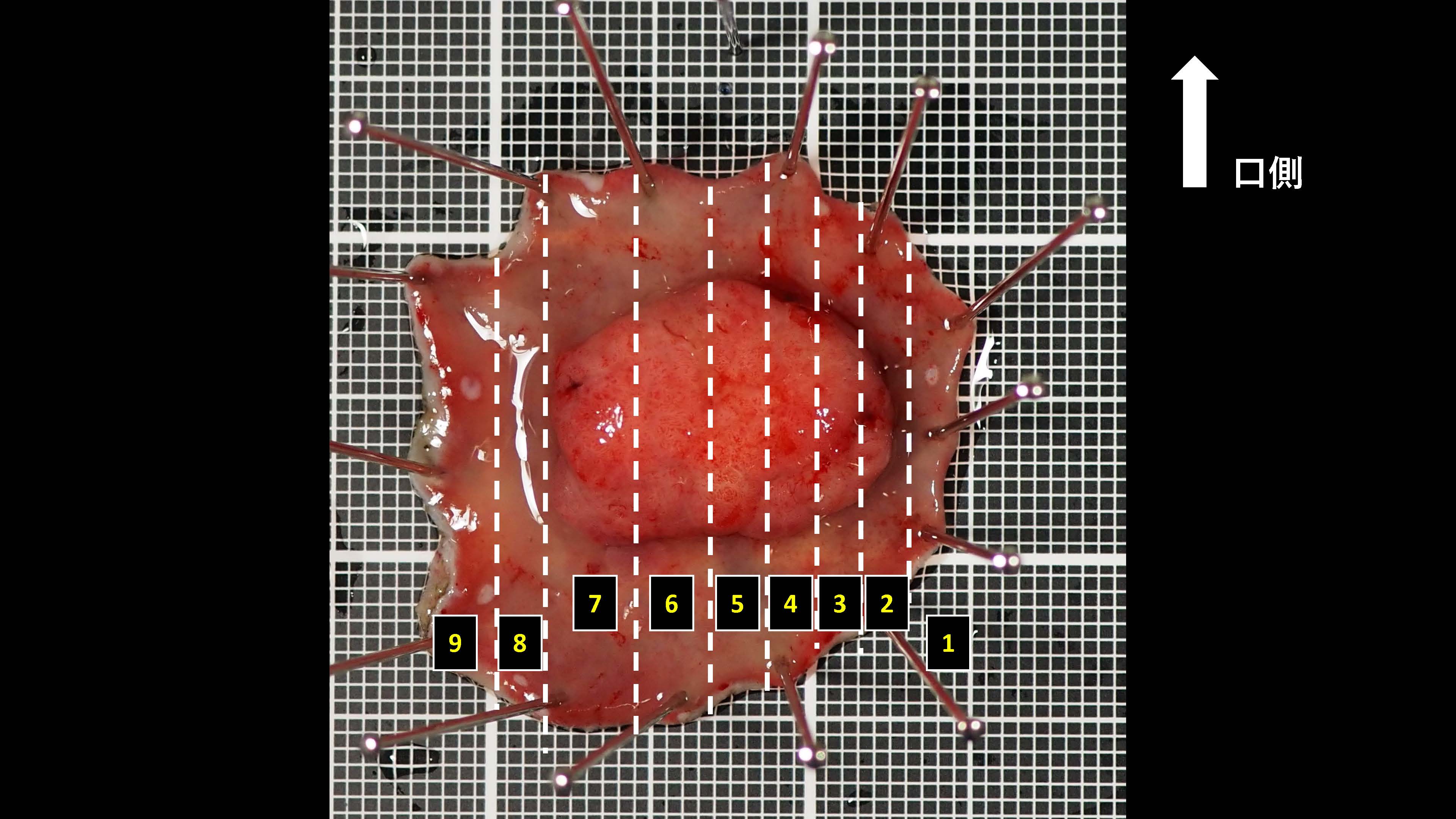 大腸025