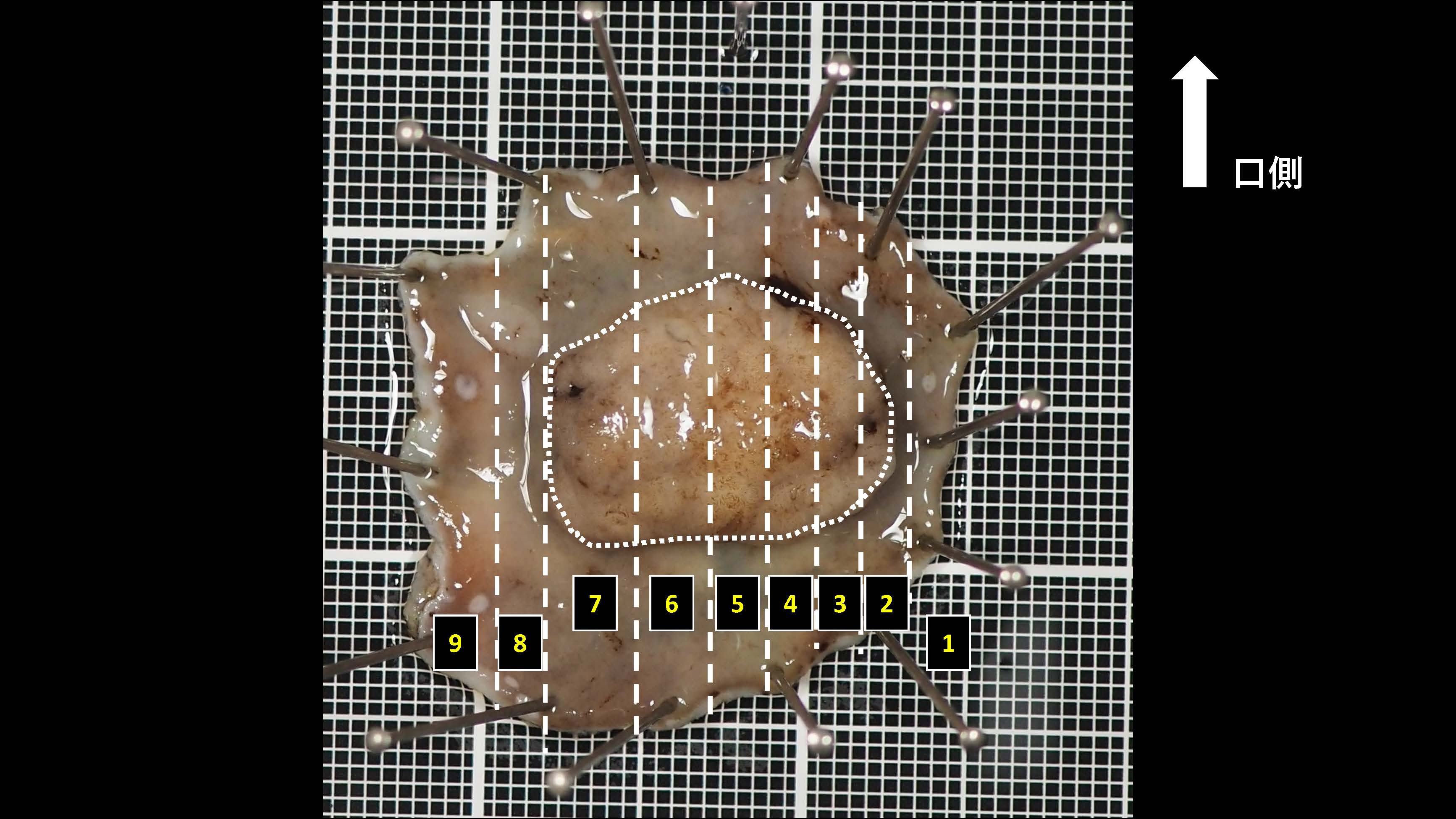 大腸028
