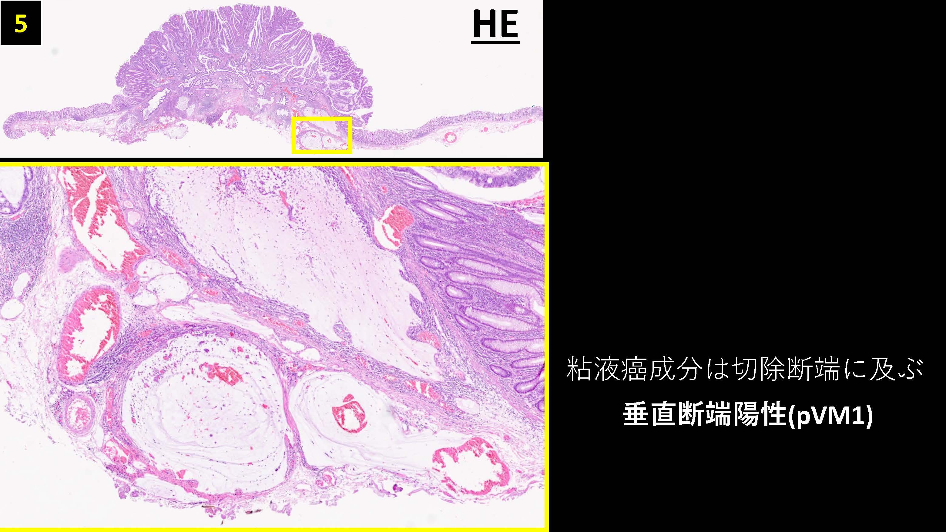 大腸040