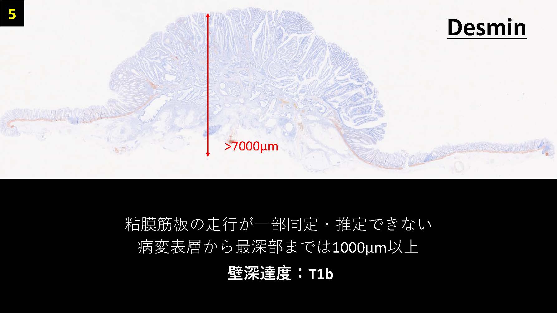 大腸042