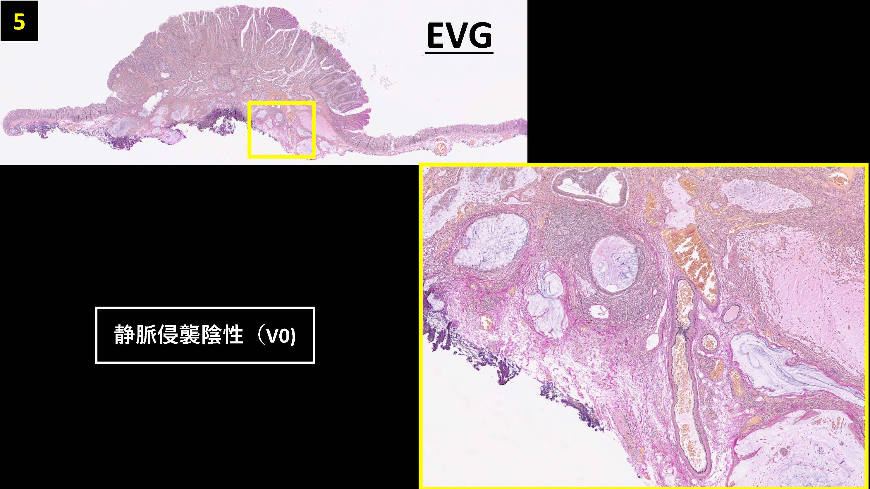 大腸045
