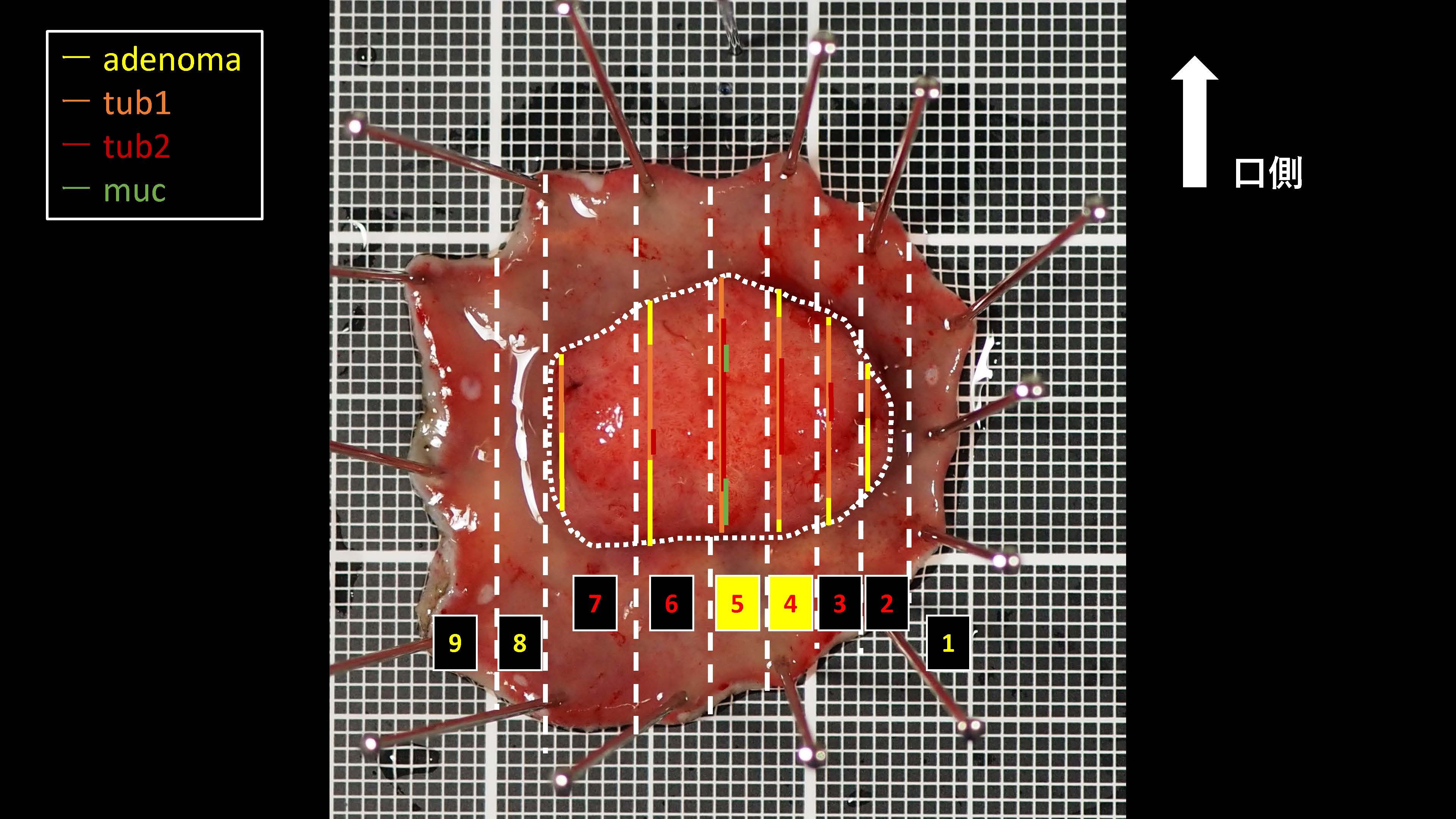 大腸053