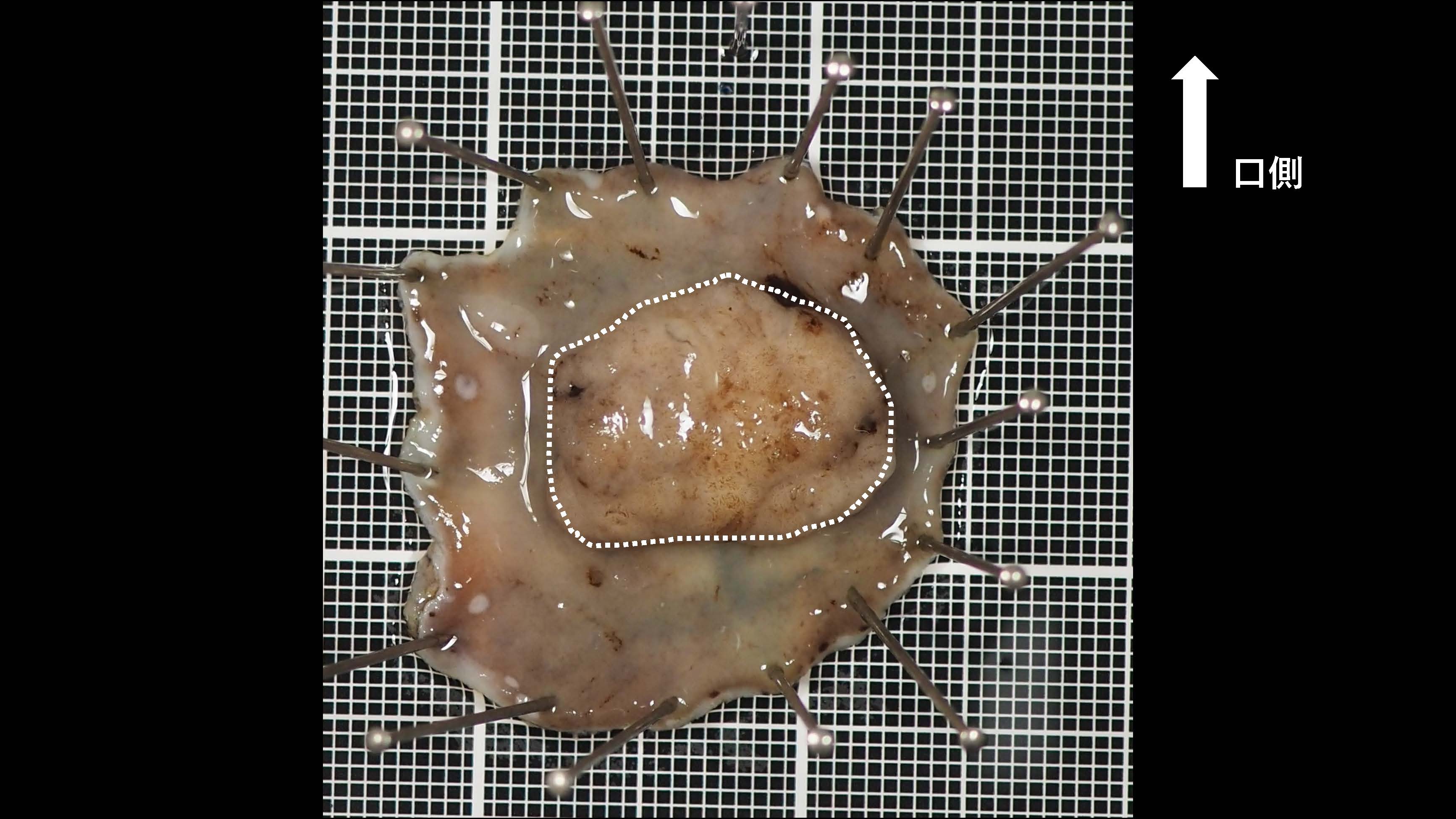 大腸056