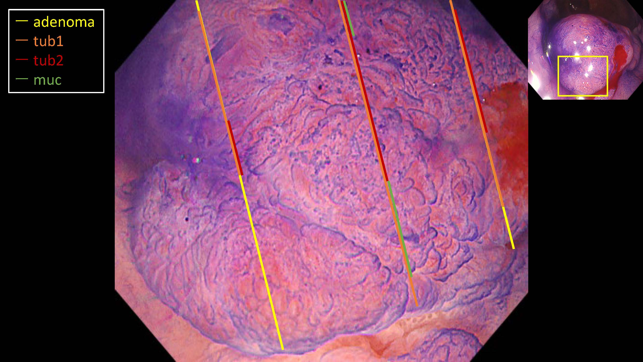 大腸091