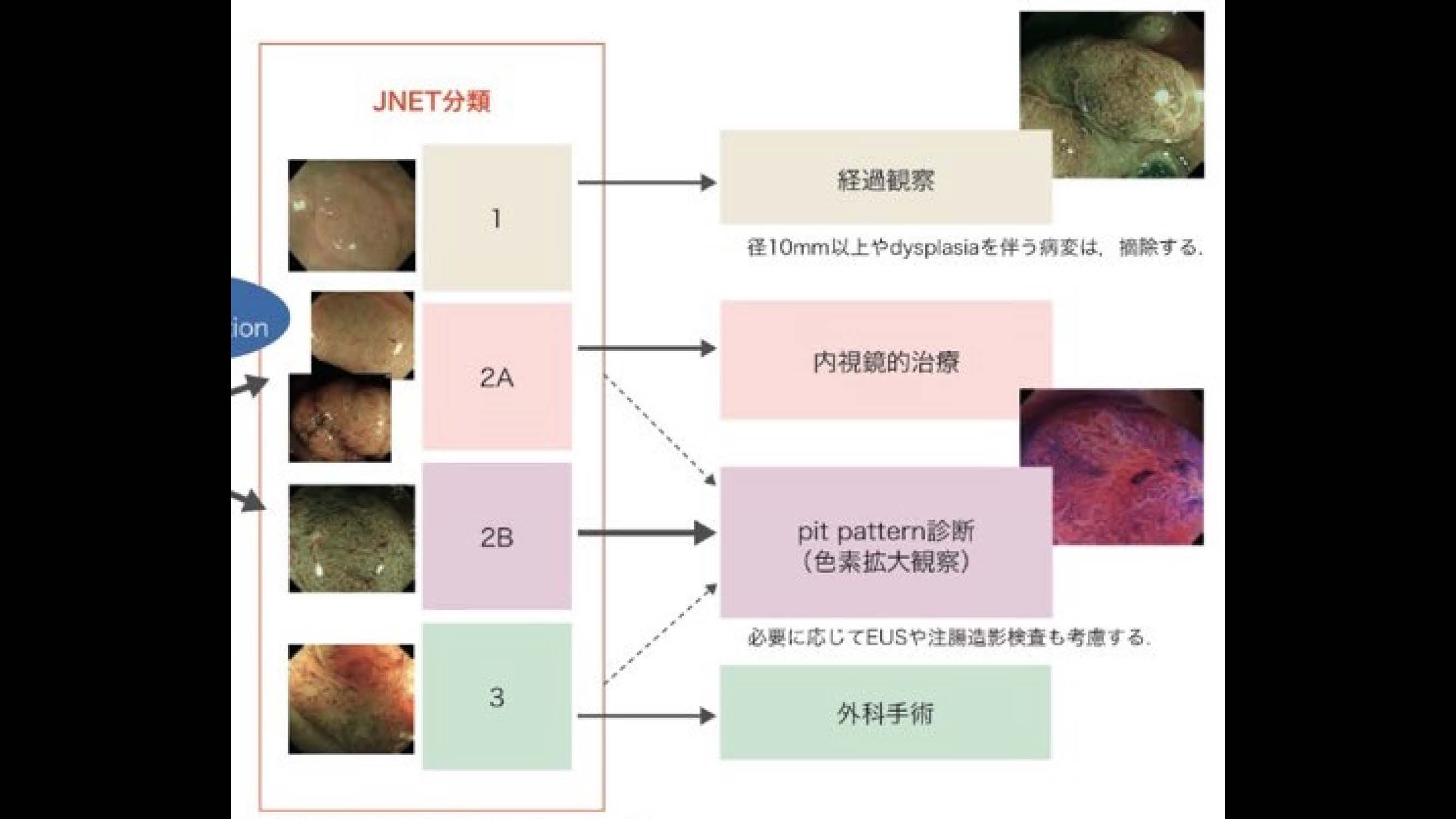 大腸095
