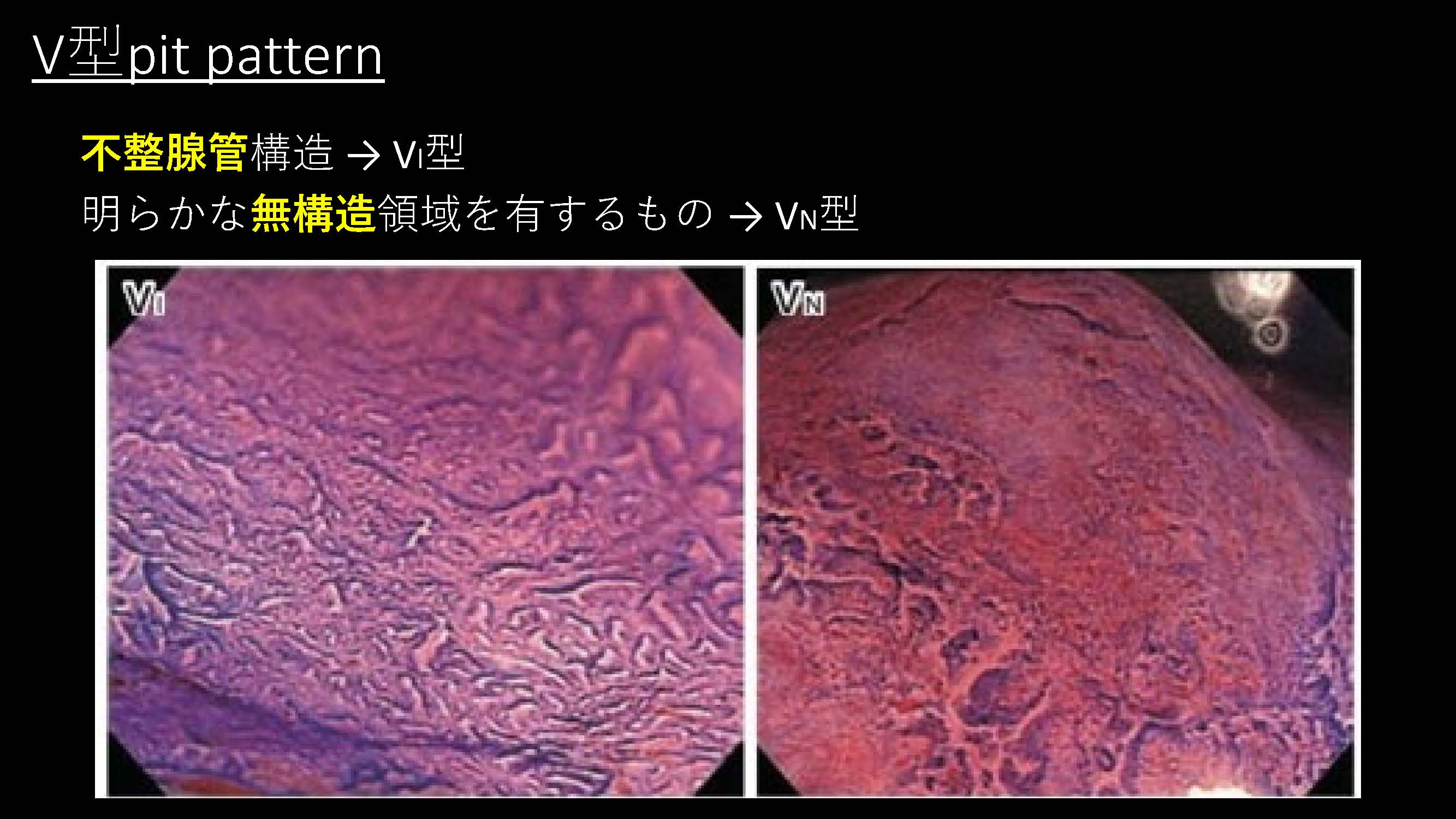 大腸097