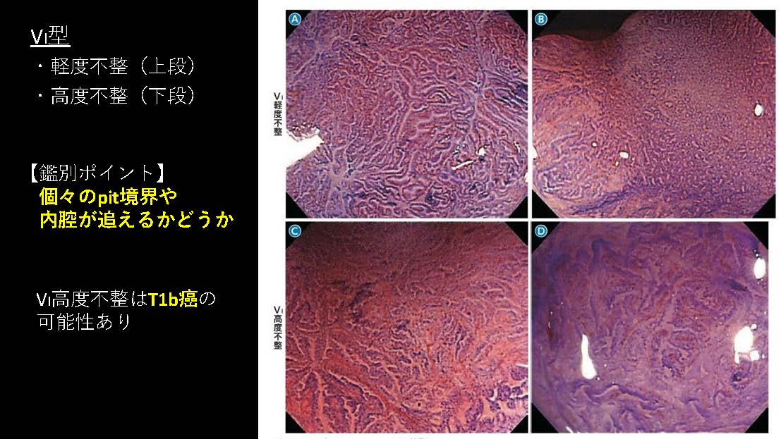 大腸098