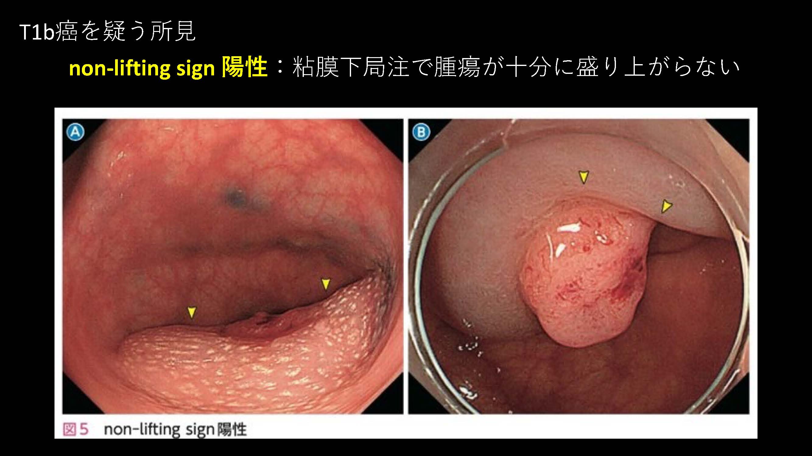 大腸099
