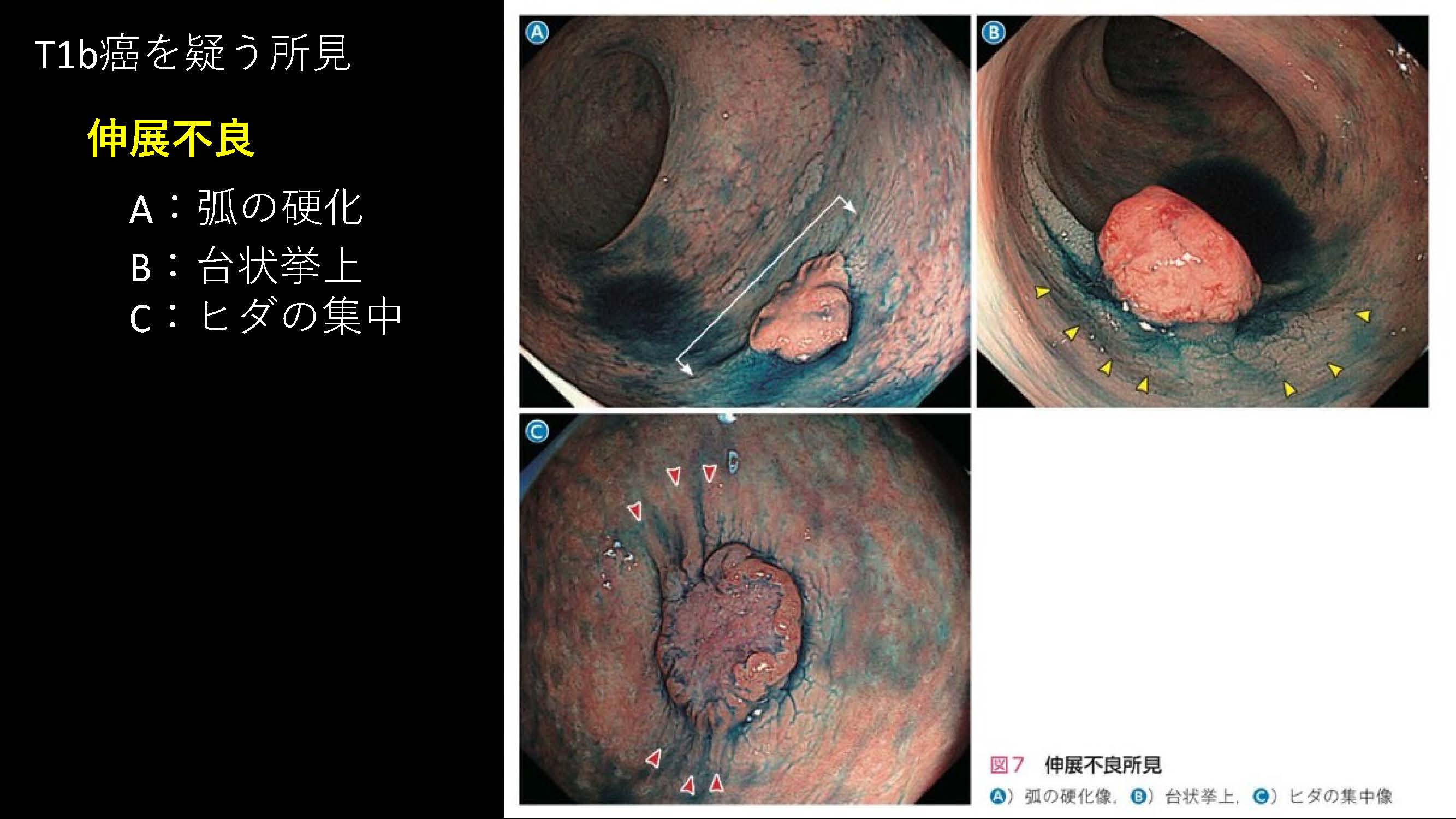 大腸100