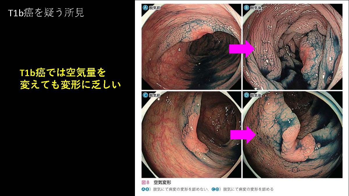 大腸101