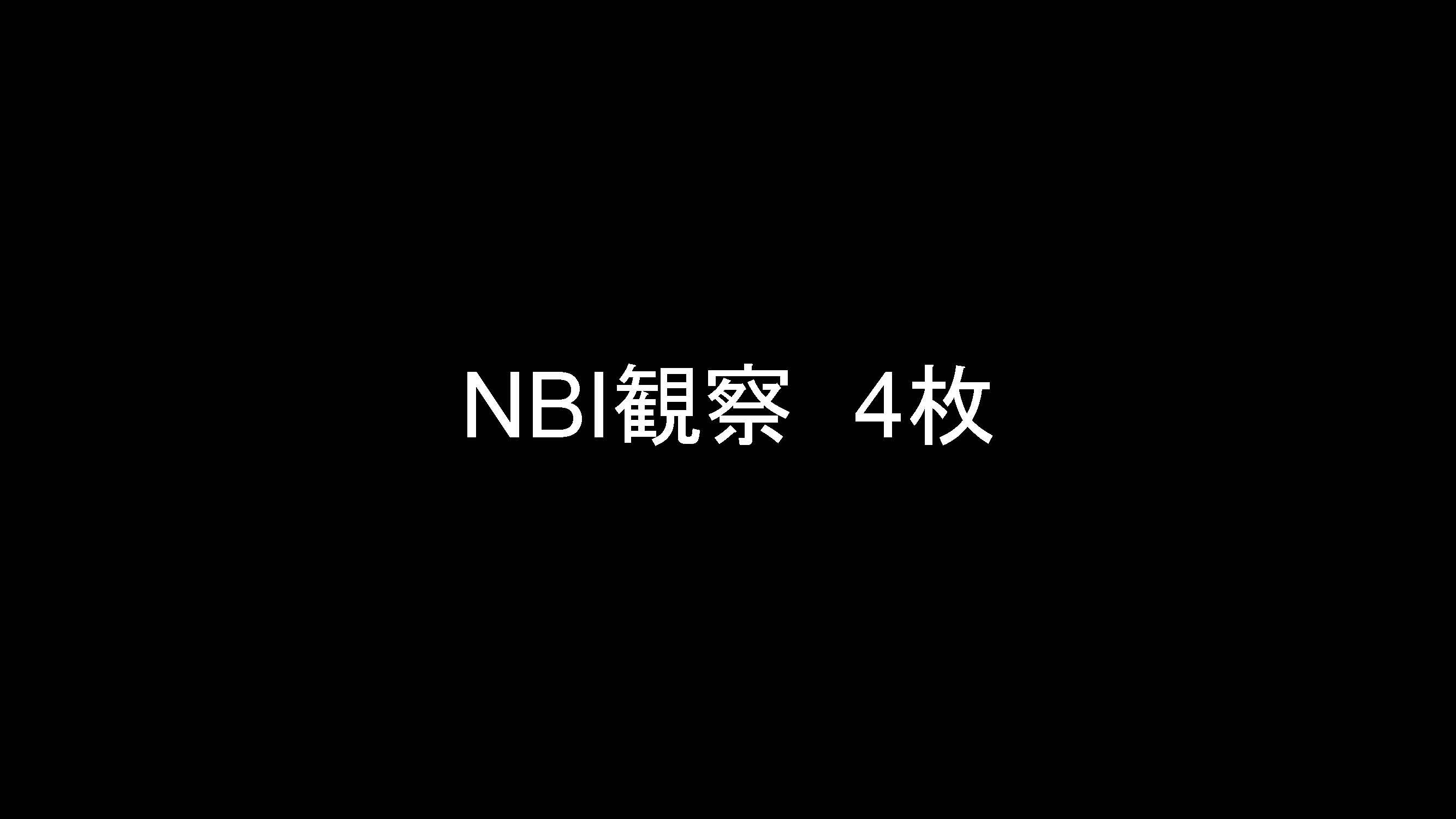 大腸007