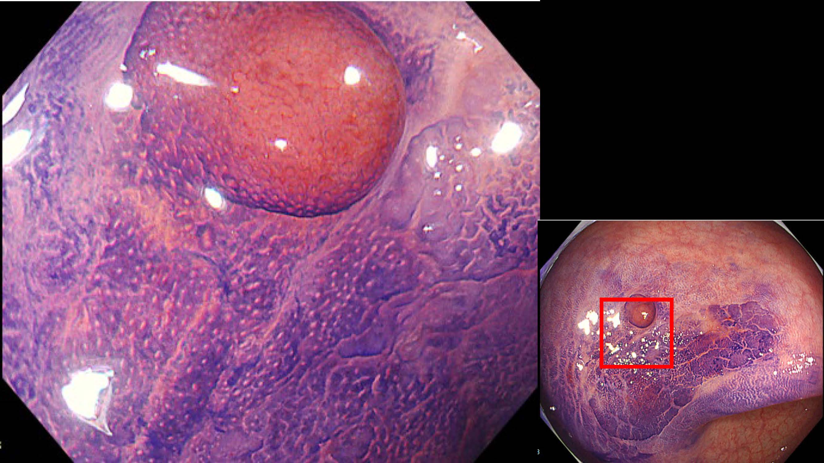 大腸015