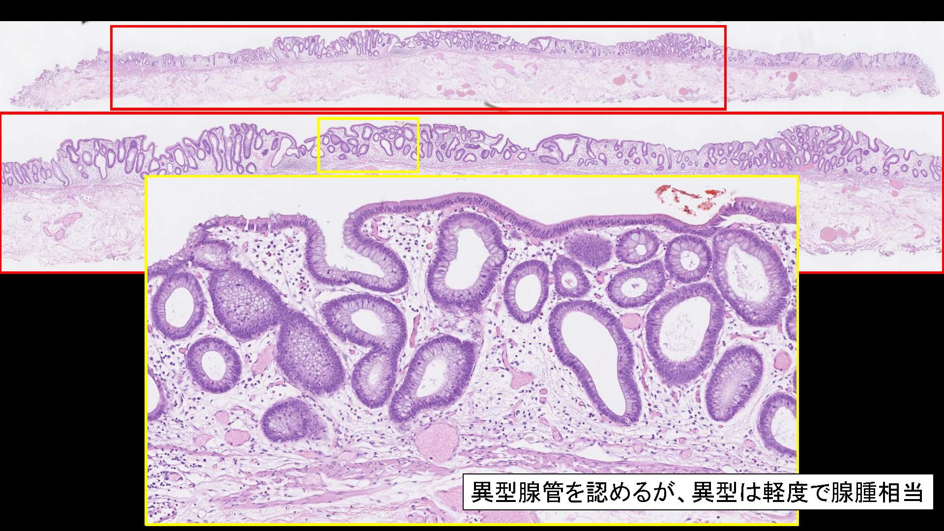 大腸033