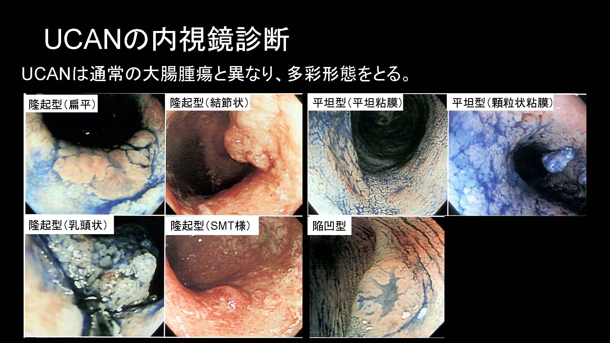 大腸039