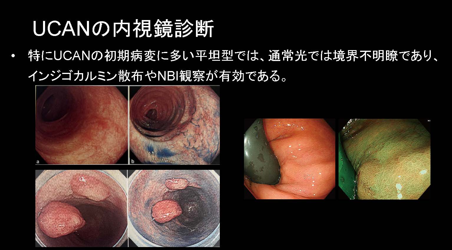 大腸040