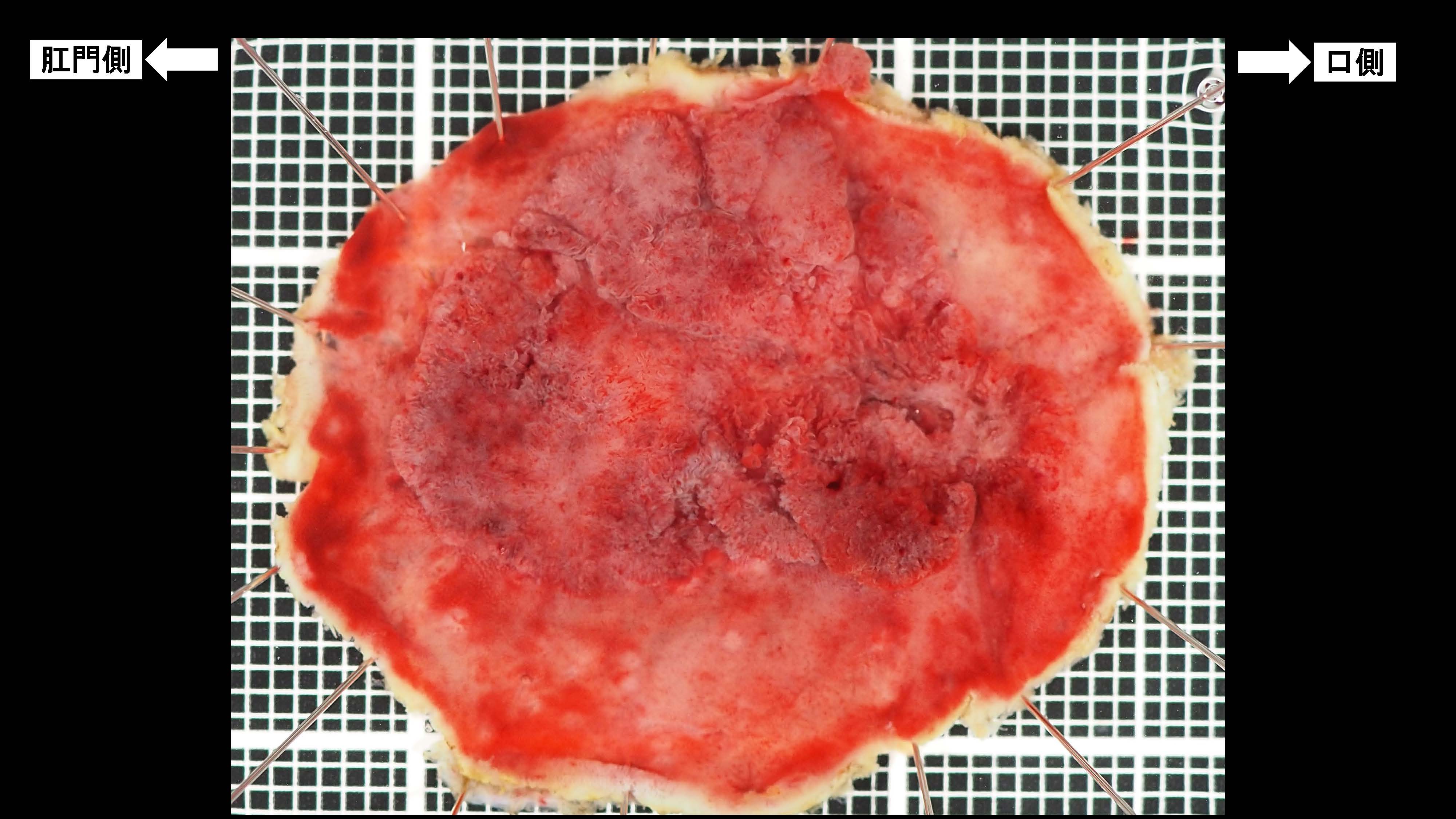大腸032
