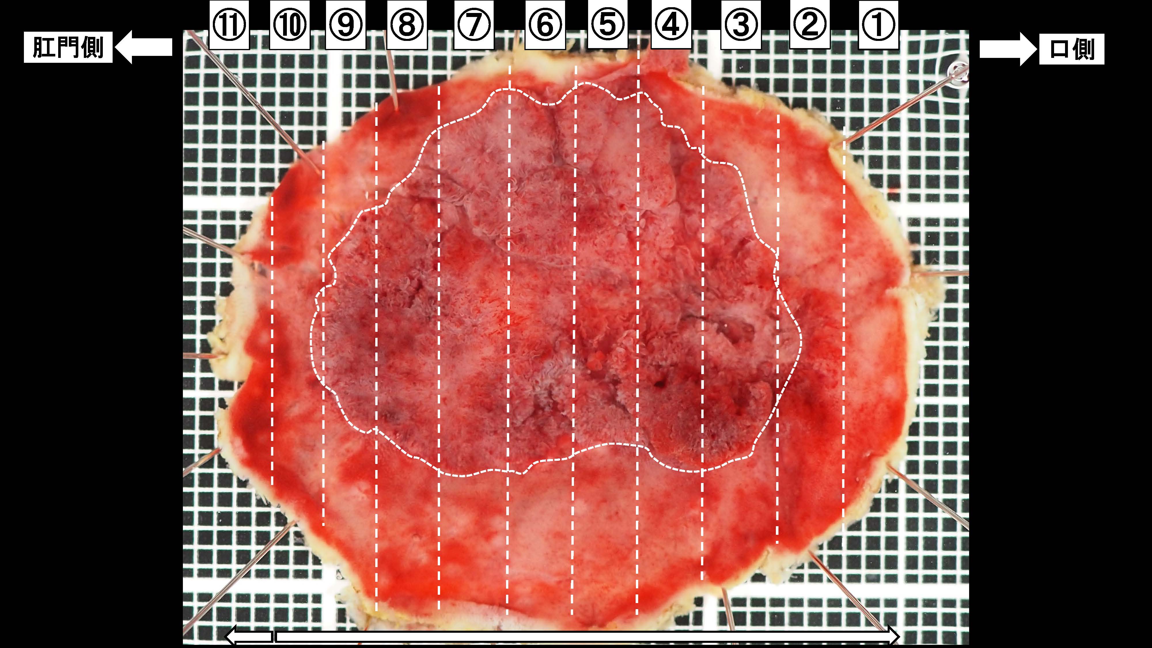 大腸034