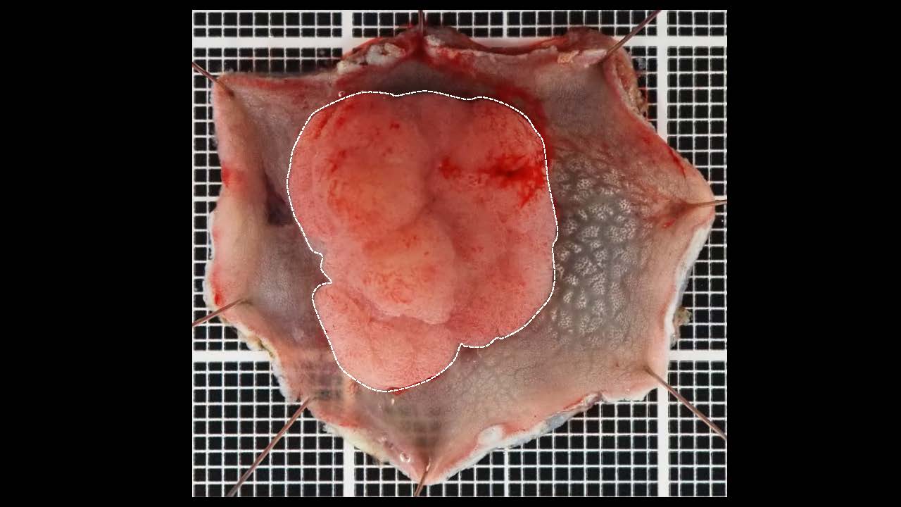 大腸040