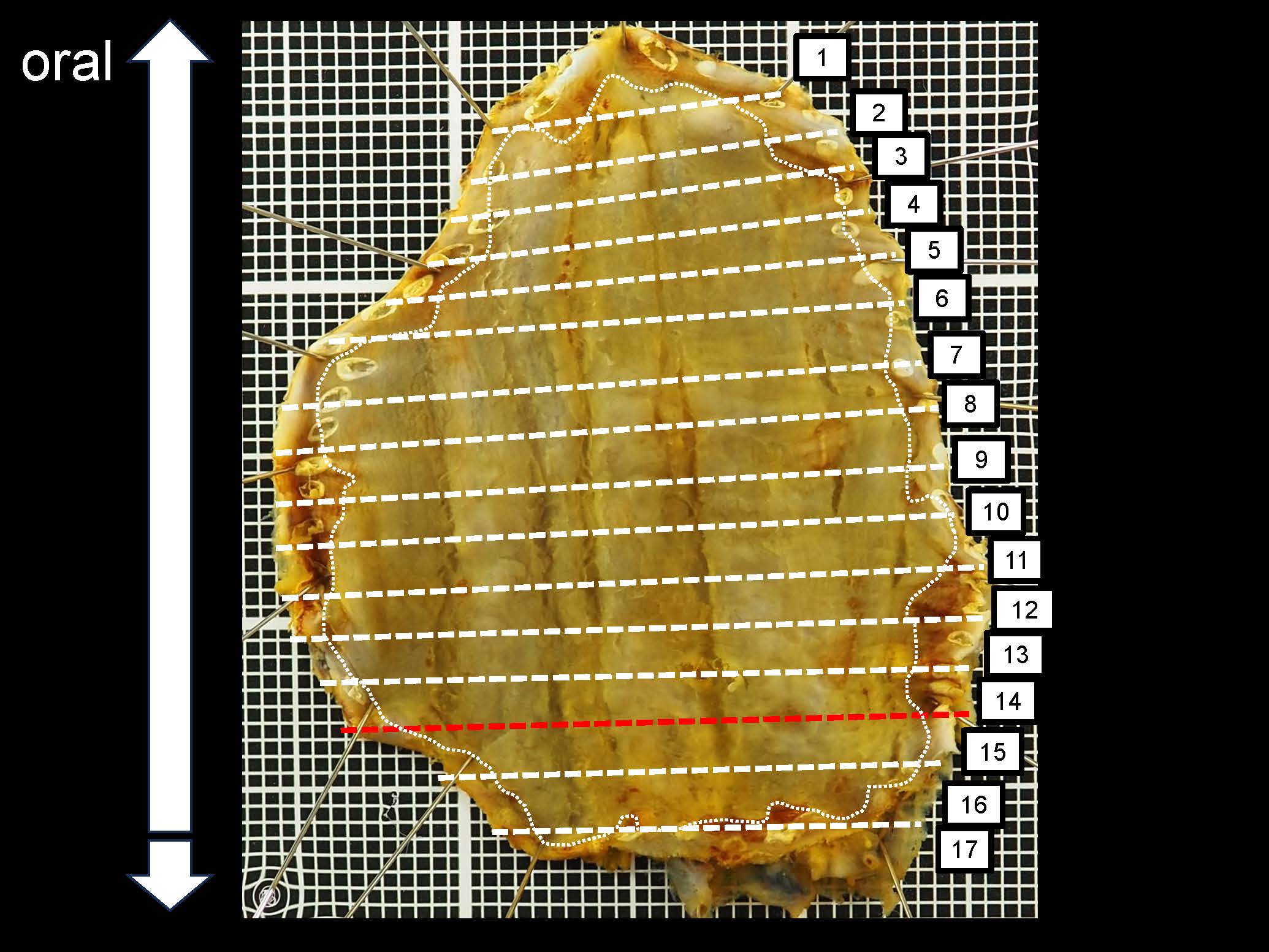 食道047