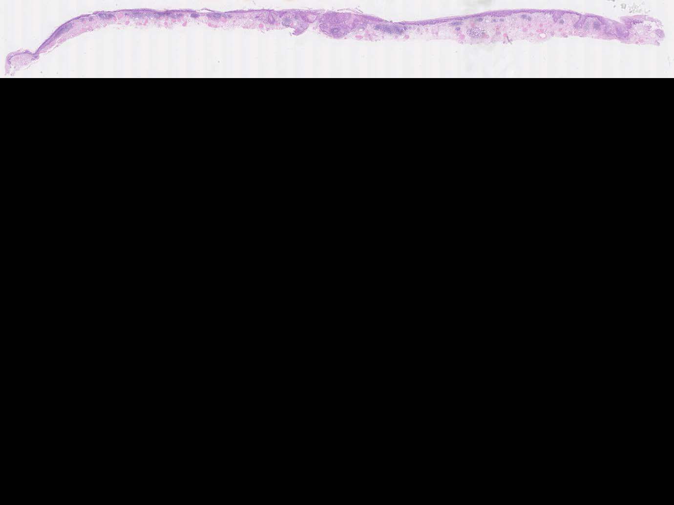 食道049