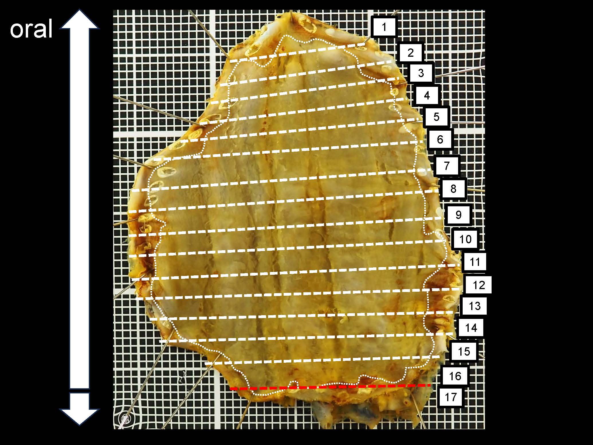 食道055