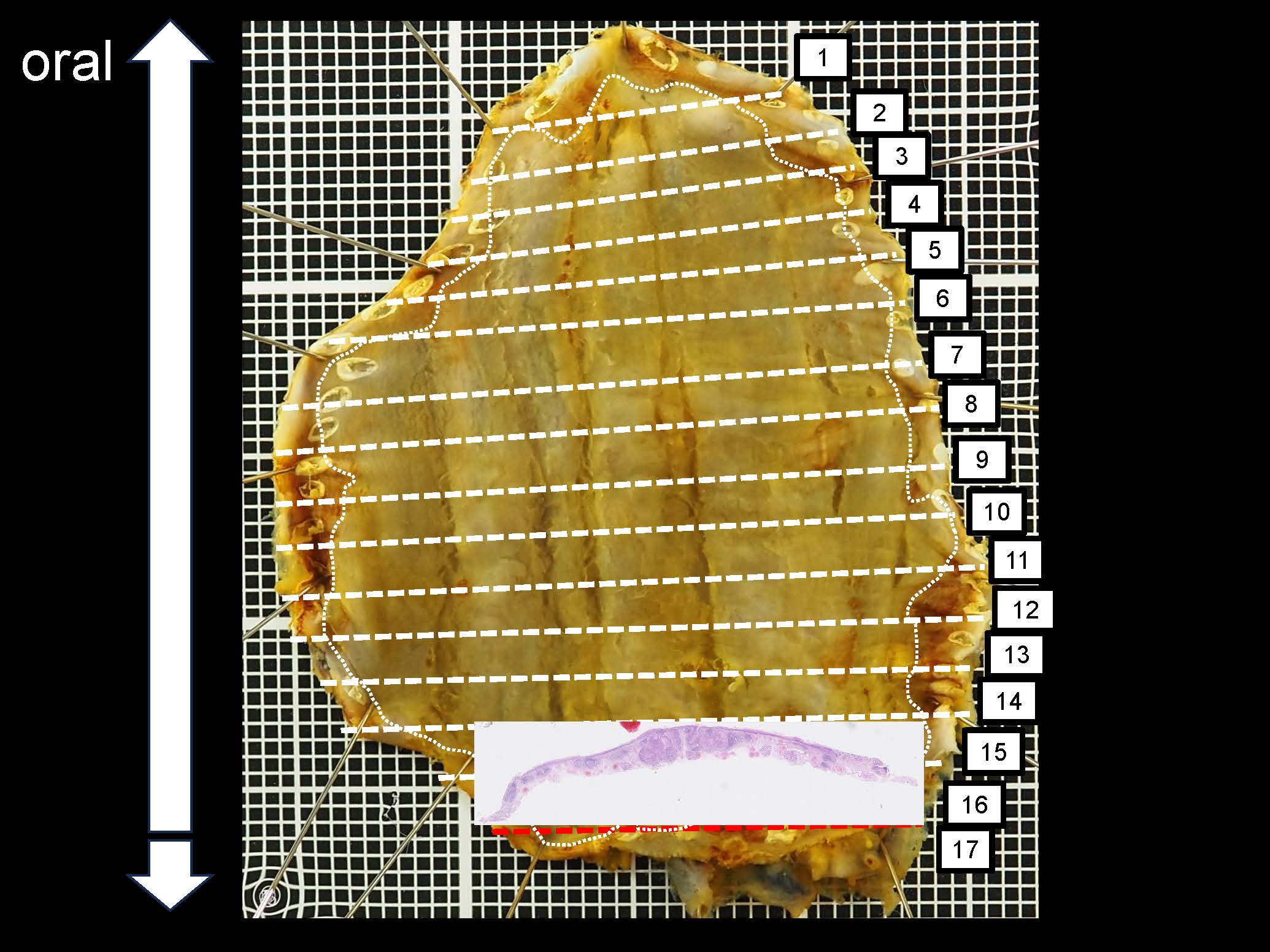 食道056