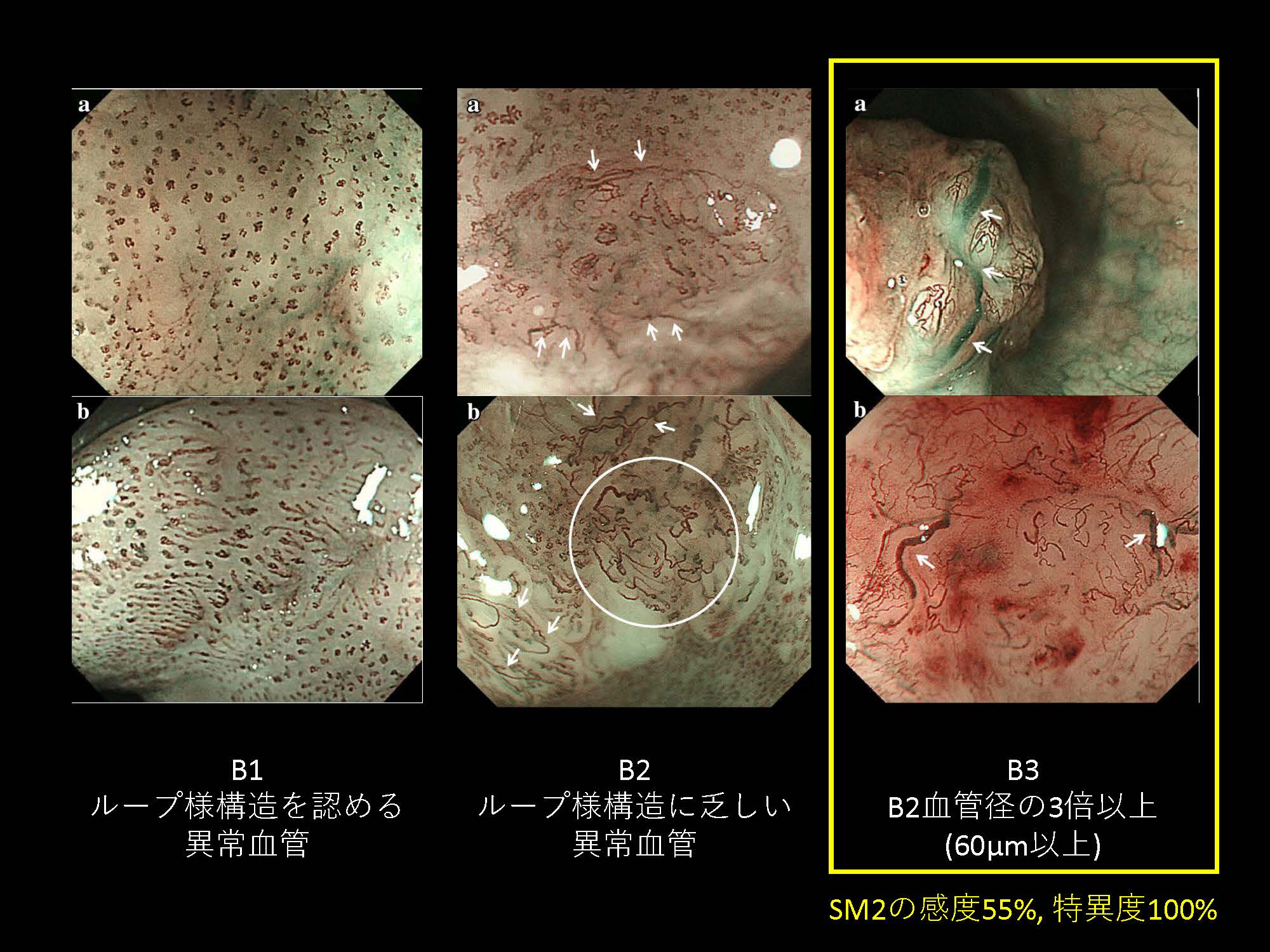 食道094