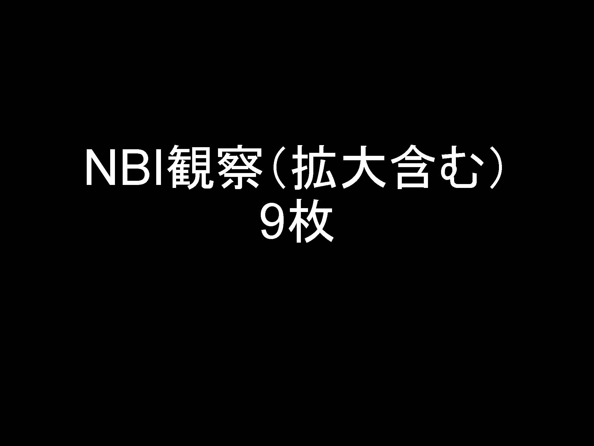 食道005