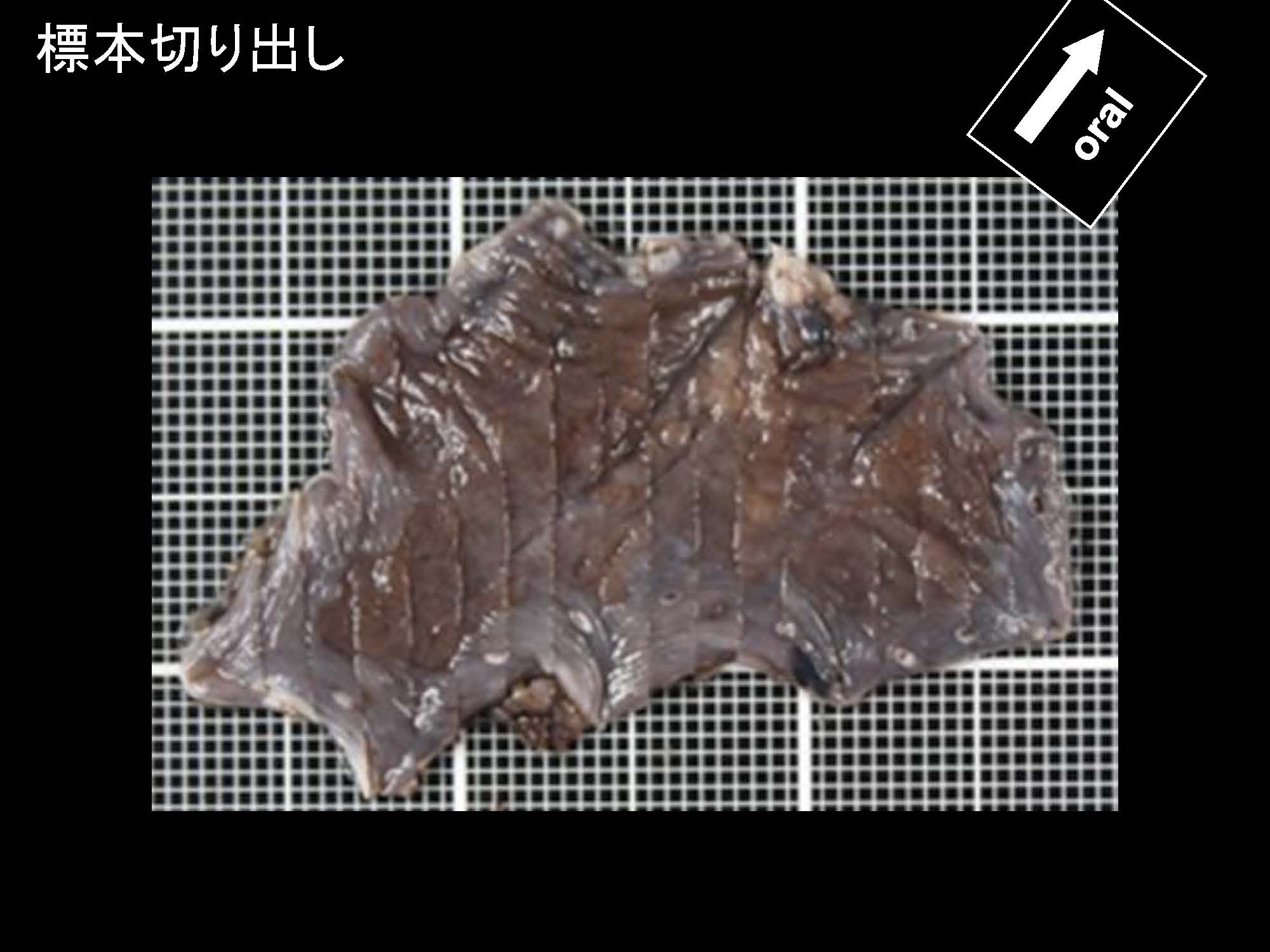 食道021