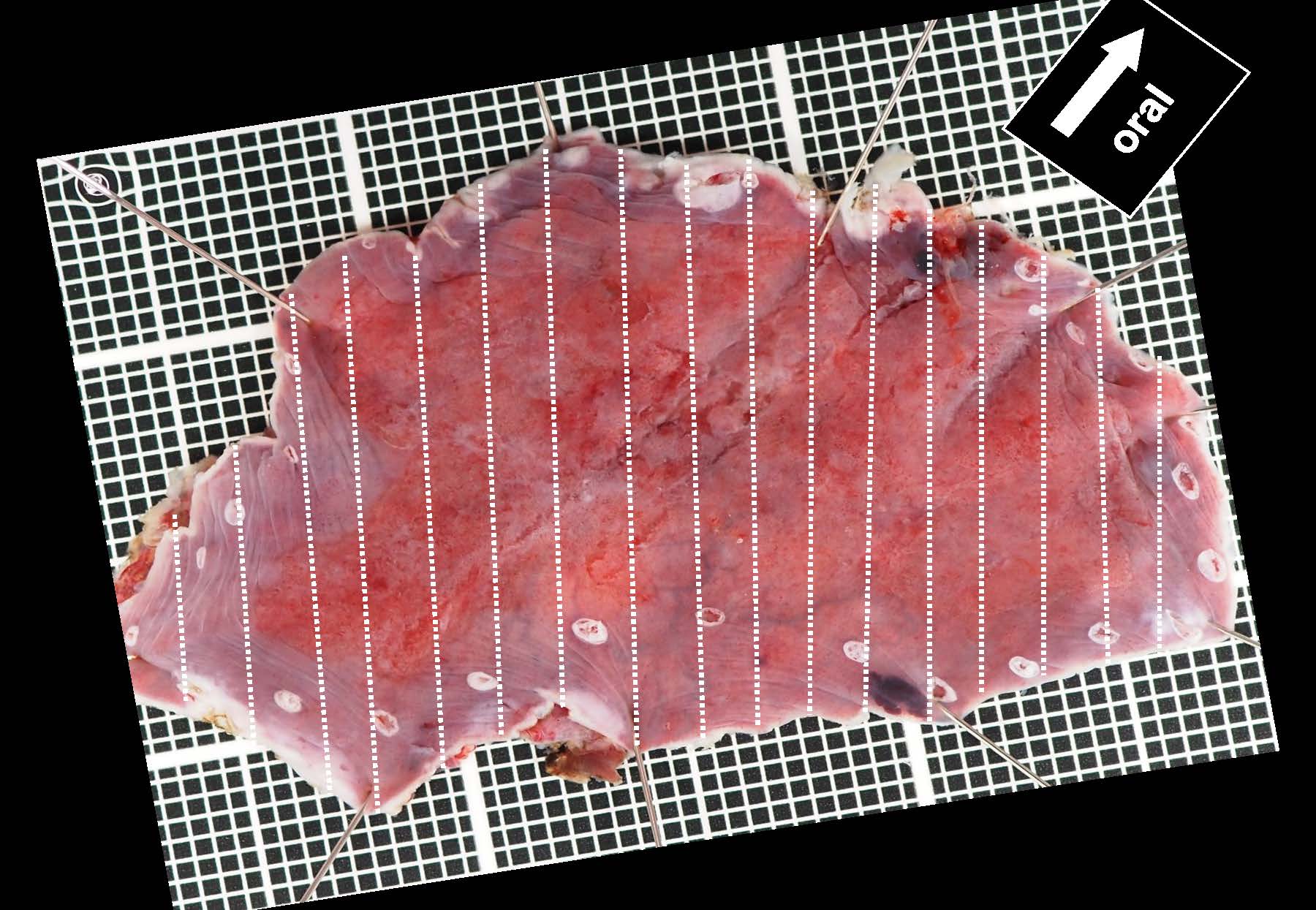 食道025