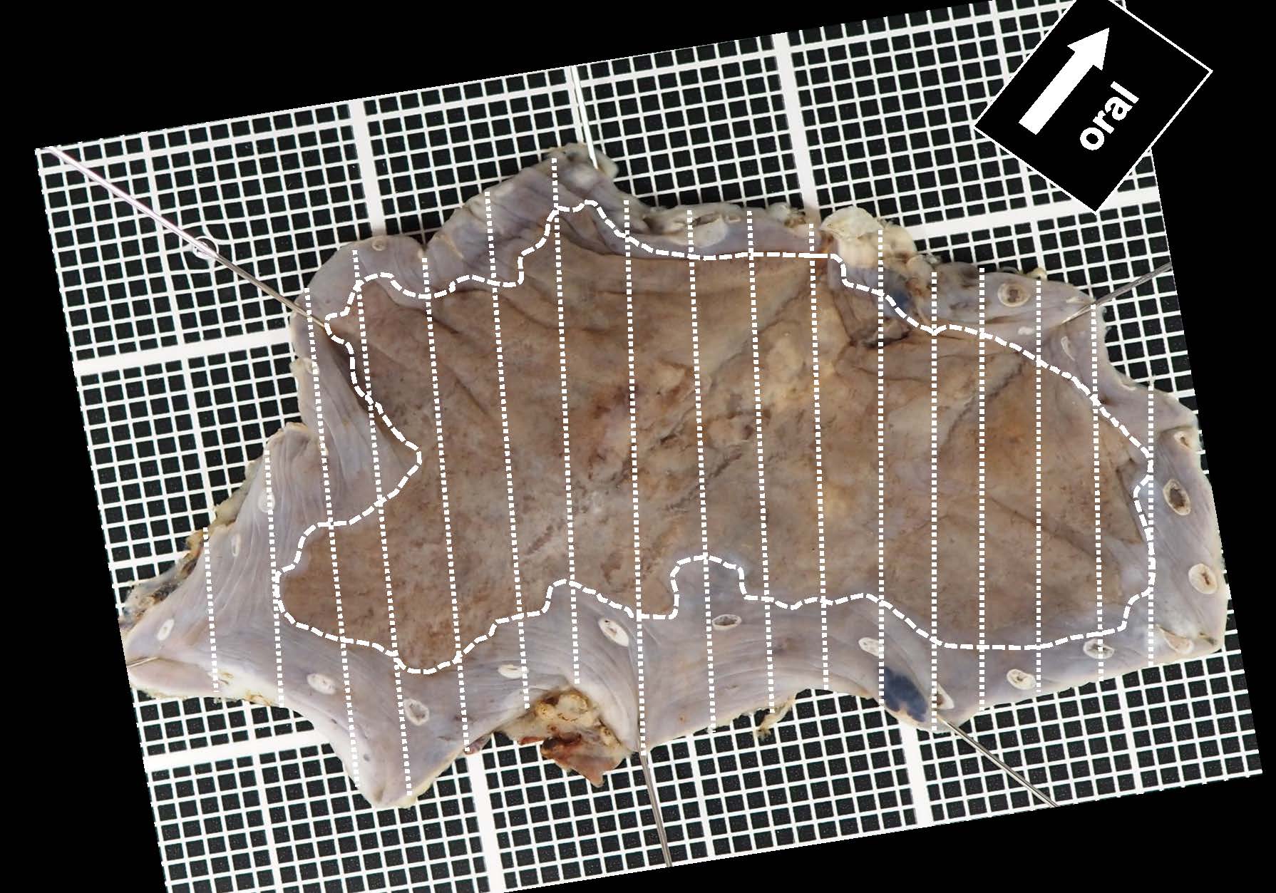 食道030