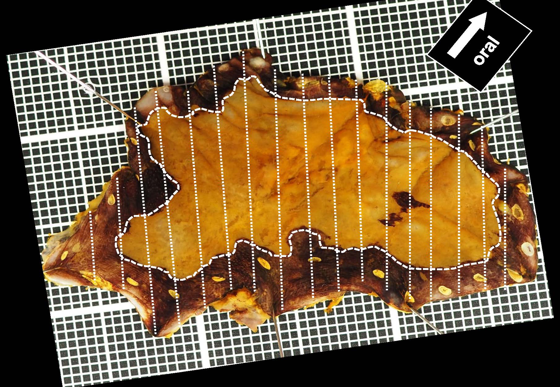 食道034