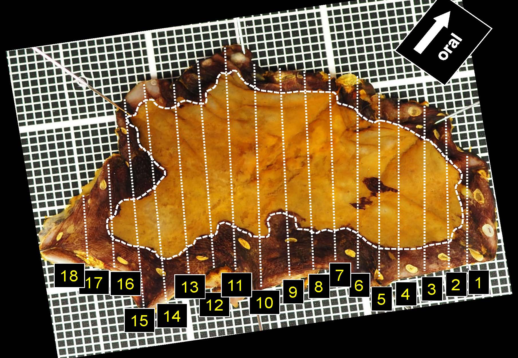 食道035