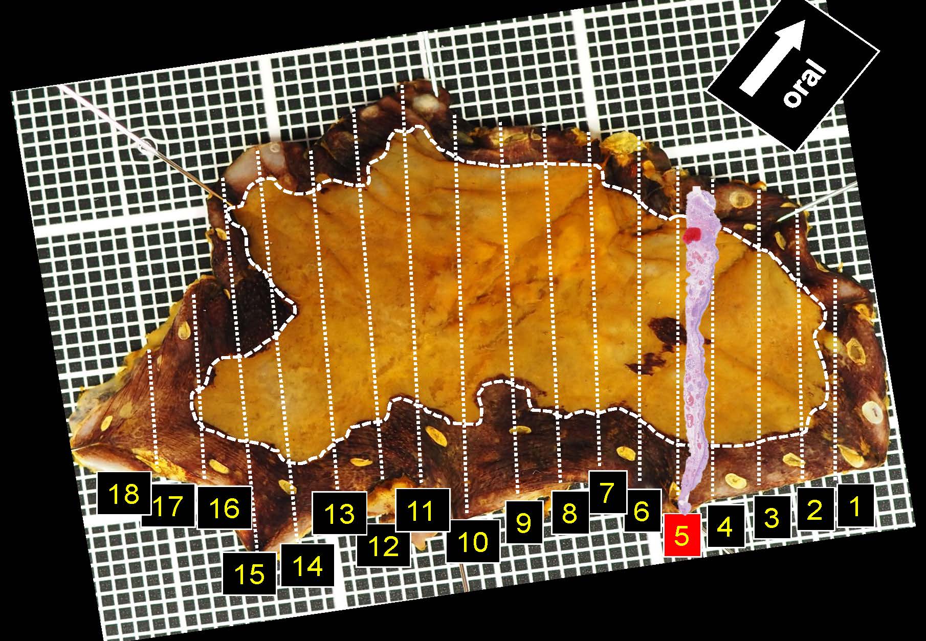 食道036
