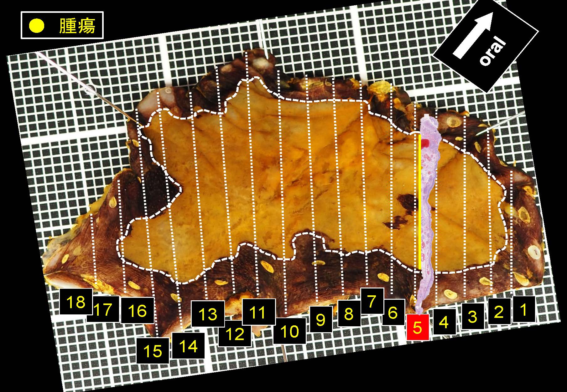 食道037