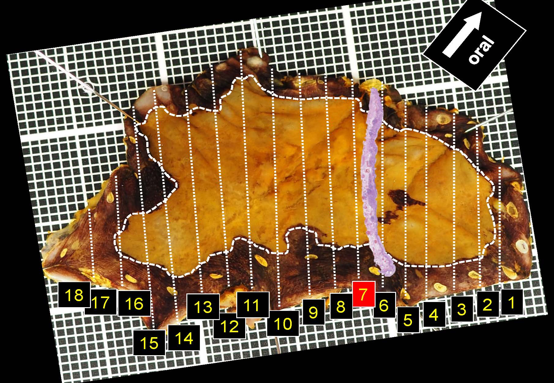 食道039