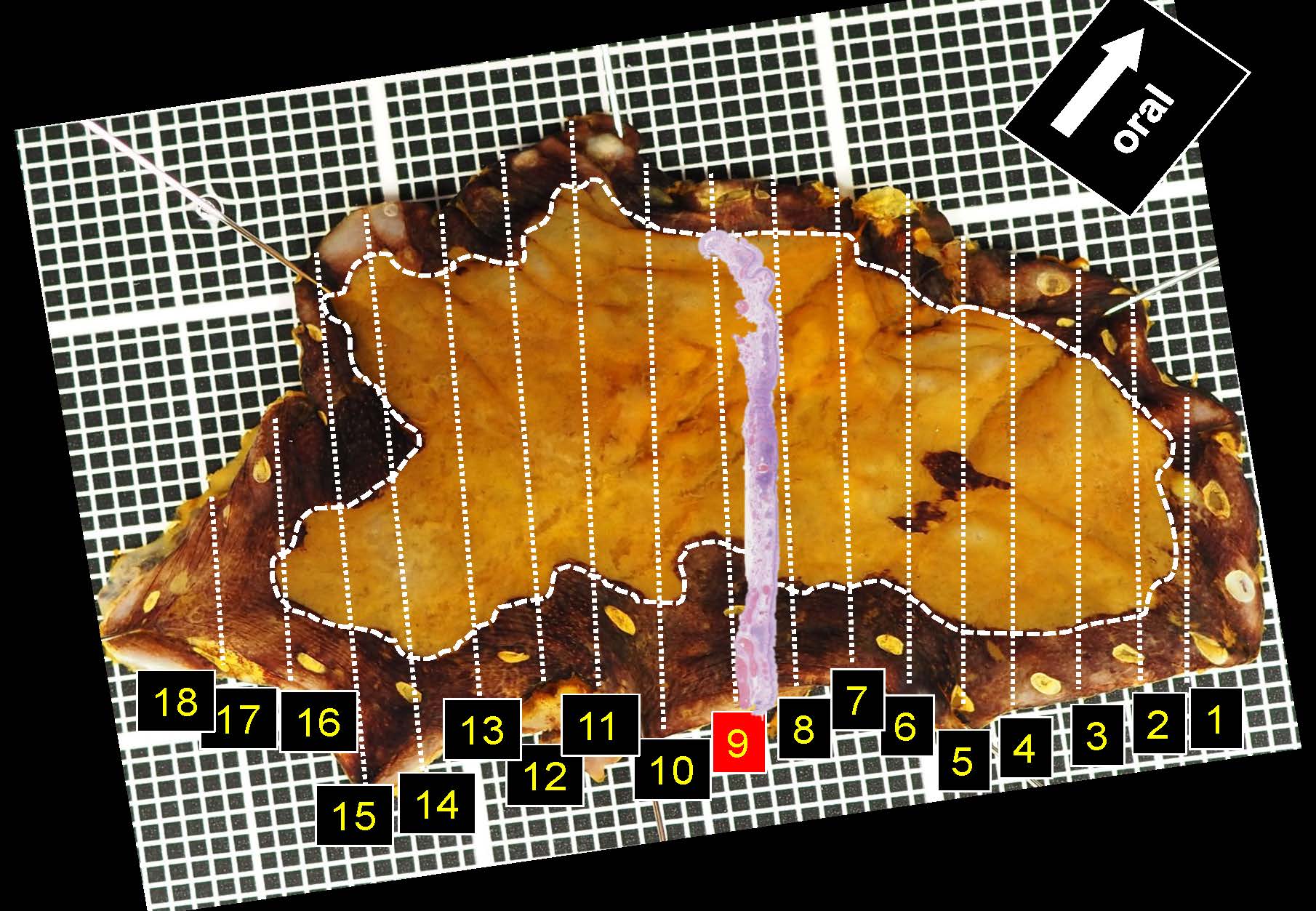 食道042