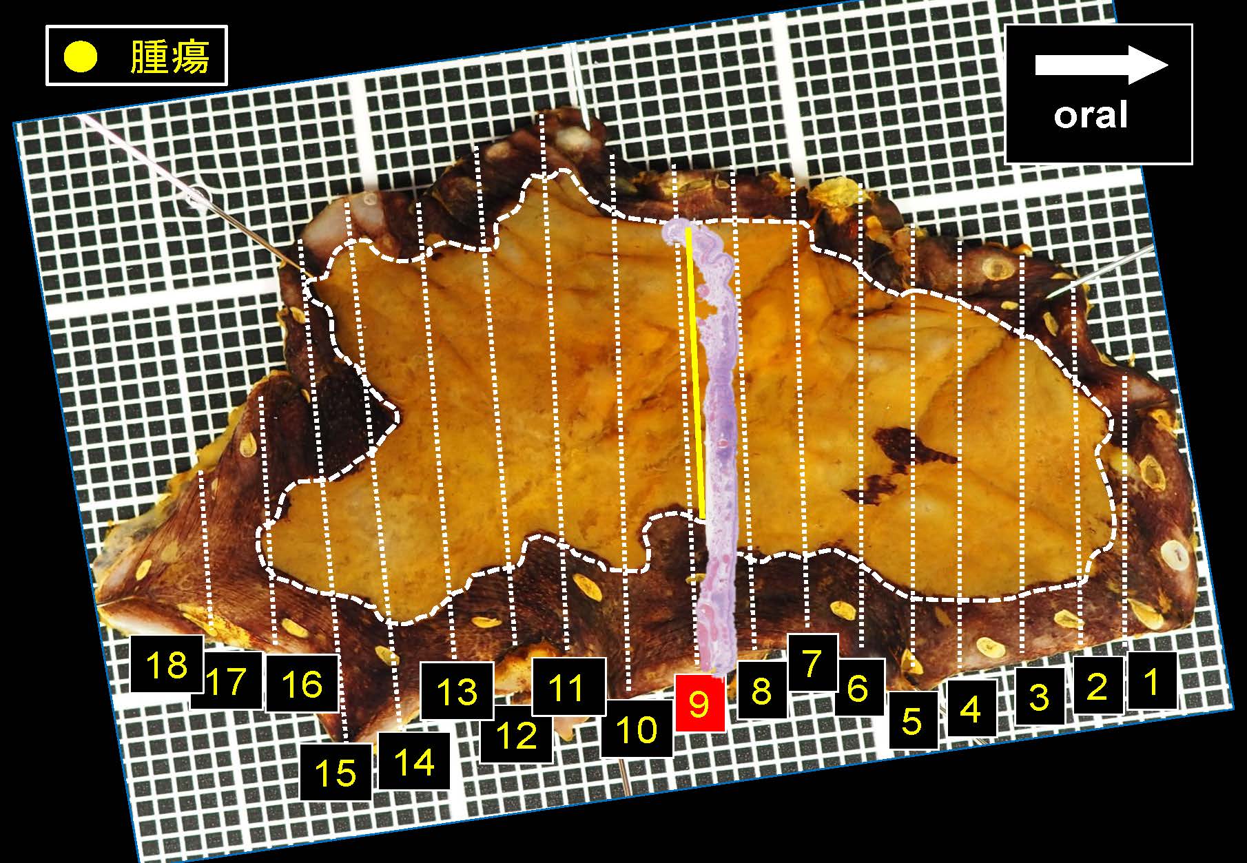 食道043